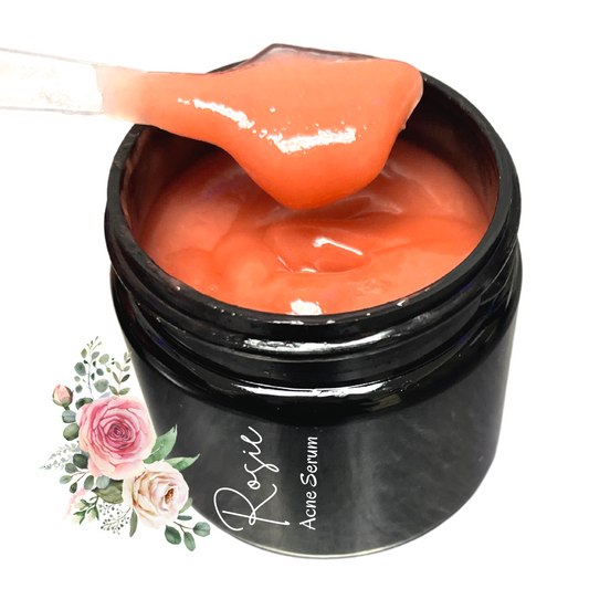 Rose Acne Serum Formula